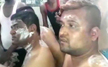 Acid attack on victory procession of Congress candidate in Tumkur, 8 injured